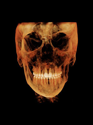 3d imaging